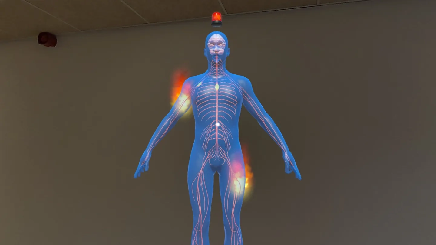 Spinal Cord Injury Education on SideQuest Oculus Quest Games & Apps ...